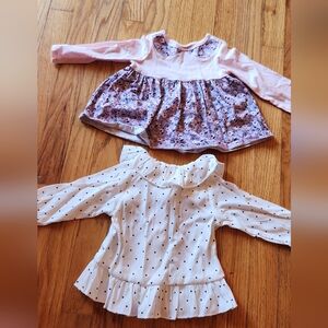 Baby girl top bundle